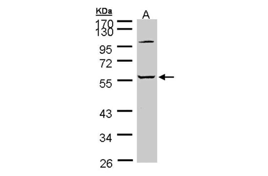 alpha 2 Glycine Receptor antibody from Signalway Antibody (23003) - Antibodies.com