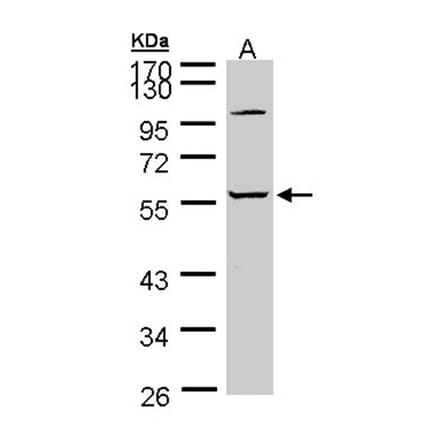 alpha 2 Glycine Receptor antibody from Signalway Antibody (23003) - Antibodies.com