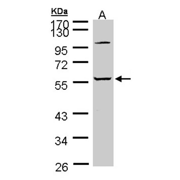 alpha 2 Glycine Receptor antibody from Signalway Antibody (23003) - Antibodies.com