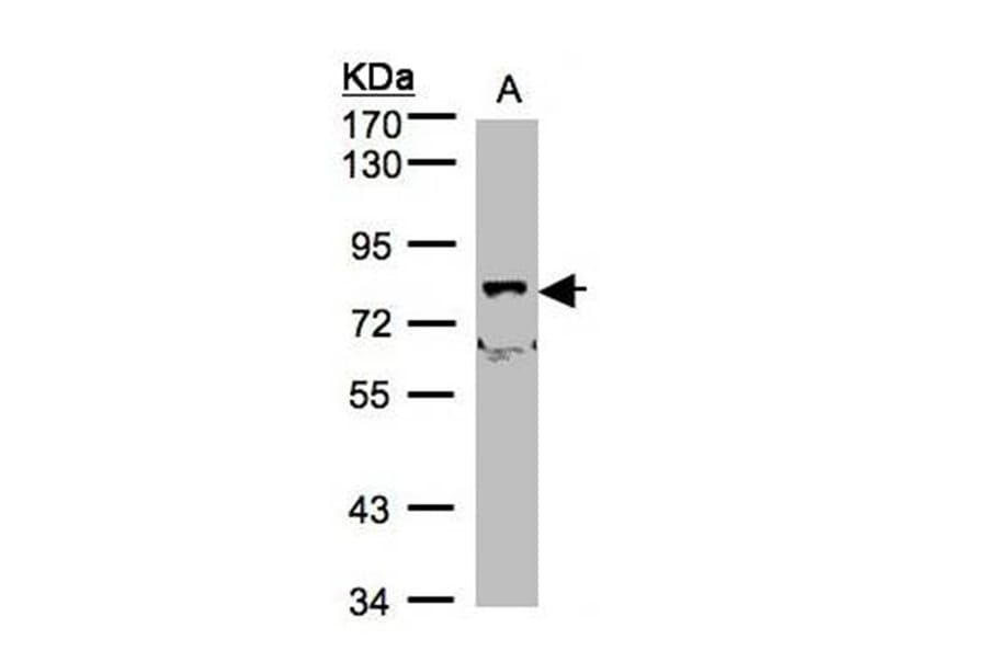 SH3KBP1 binding protein 1 antibody from Signalway Antibody (23162) - Antibodies.com