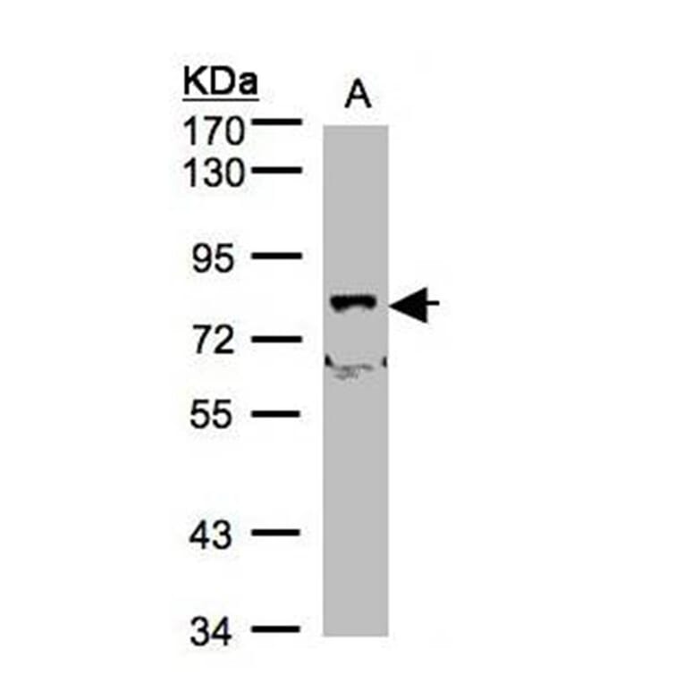 SH3KBP1 binding protein 1 antibody from Signalway Antibody (23162) - Antibodies.com