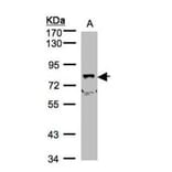SH3KBP1 binding protein 1 antibody from Signalway Antibody (23162) - Antibodies.com