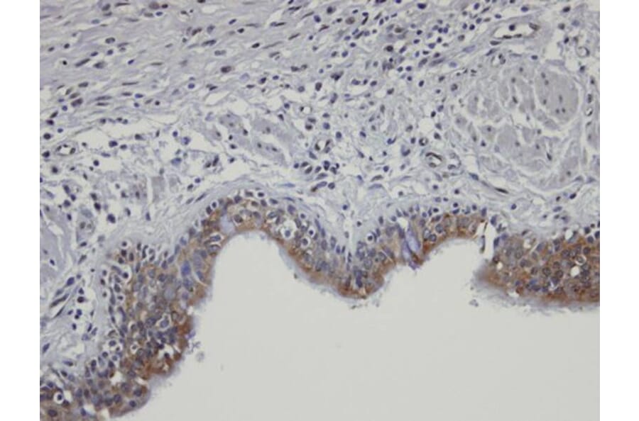 Immunohistochemistry - SH3KBP1 binding protein 1 antibody from Signalway Antibody (23162) - Antibodies.com