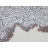 Immunohistochemistry - SH3KBP1 binding protein 1 antibody from Signalway Antibody (23162) - Antibodies.com