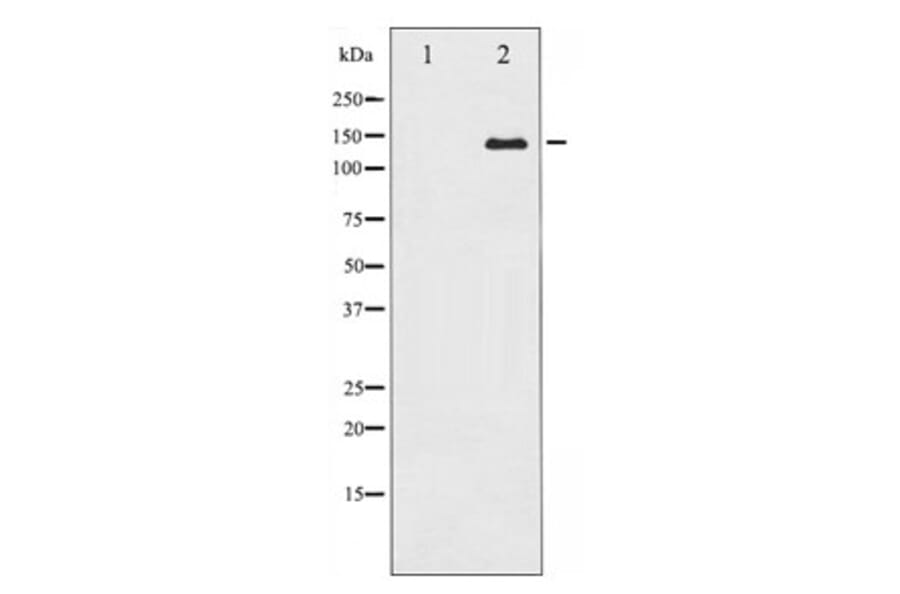 Western blot - Calcium Sensing Receptor Antibody from Signalway Antibody (29236) - Antibodies.com