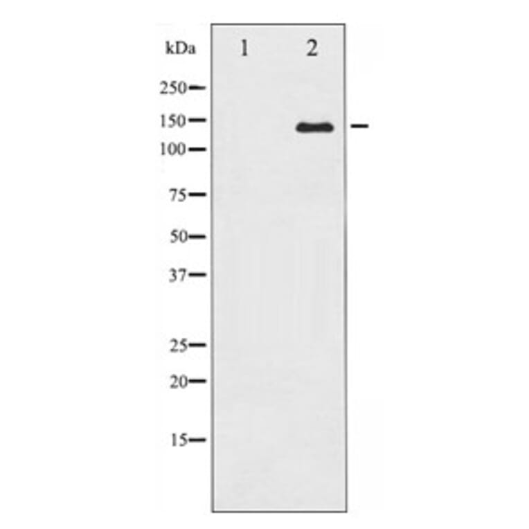 Western blot - Calcium Sensing Receptor Antibody from Signalway Antibody (29236) - Antibodies.com