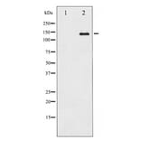 Western blot - Calcium Sensing Receptor Antibody from Signalway Antibody (29236) - Antibodies.com