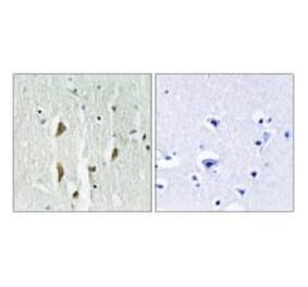 Immunohistochemistry - PAK1/2/3 (Ab-423/402/421) Antibody from Signalway Antibody (33140) - Antibodies.com