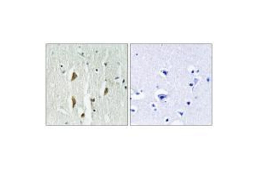 Immunohistochemistry - PAK1/2/3 (Ab-423/402/421) Antibody from Signalway Antibody (33140) - Antibodies.com