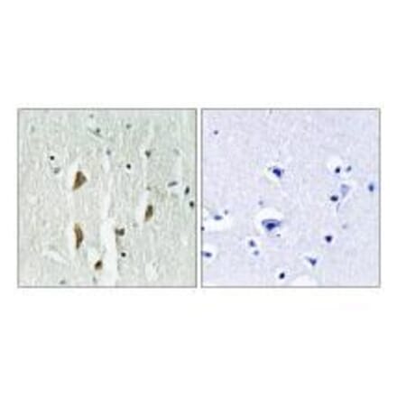 Immunohistochemistry - PAK1/2/3 (Ab-423/402/421) Antibody from Signalway Antibody (33140) - Antibodies.com