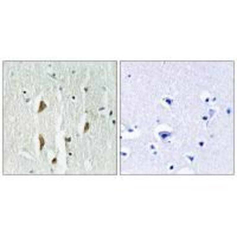Immunohistochemistry - PAK1/2/3 (Ab-423/402/421) Antibody from Signalway Antibody (33140) - Antibodies.com