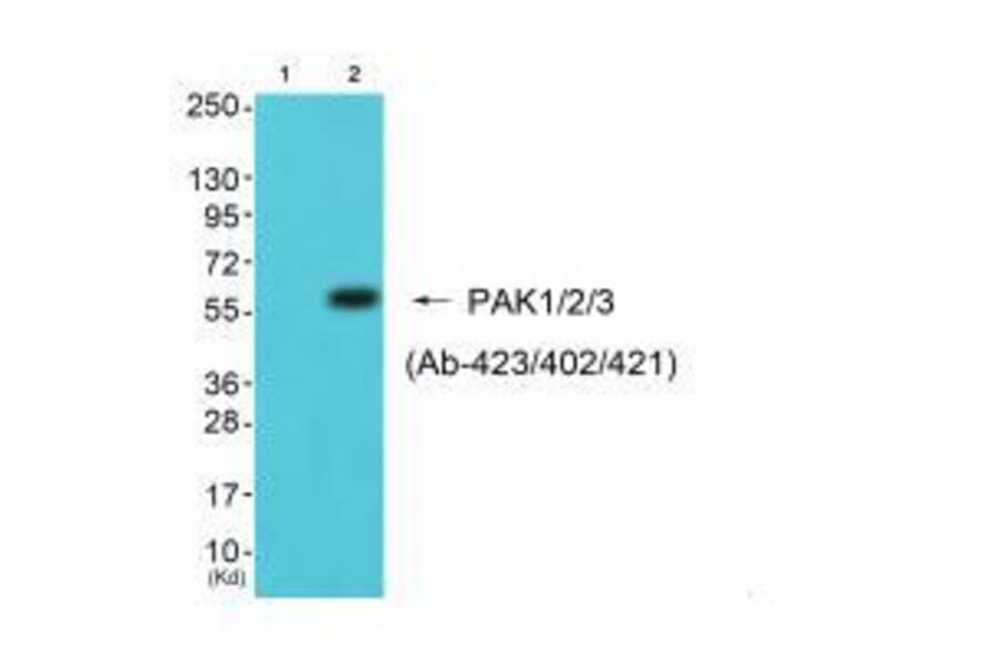 Western blot - PAK1/2/3 (Ab-423/402/421) Antibody from Signalway Antibody (33140) - Antibodies.com