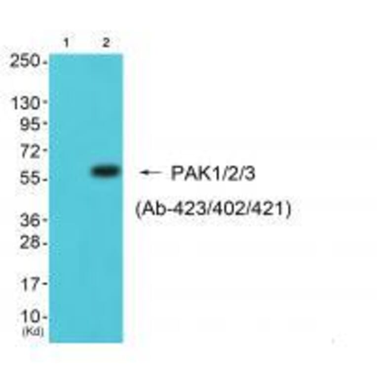 Western blot - PAK1/2/3 (Ab-423/402/421) Antibody from Signalway Antibody (33140) - Antibodies.com