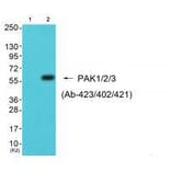 Western blot - PAK1/2/3 (Ab-423/402/421) Antibody from Signalway Antibody (33140) - Antibodies.com