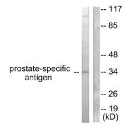 Western blot - Prostate-specific Antigen Antibody from Signalway Antibody (33477) - Antibodies.com