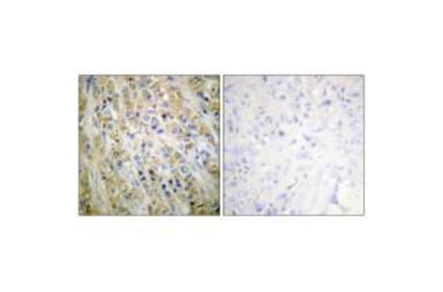 Immunohistochemistry - Prostate-specific Antigen Antibody from Signalway Antibody (33477) - Antibodies.com