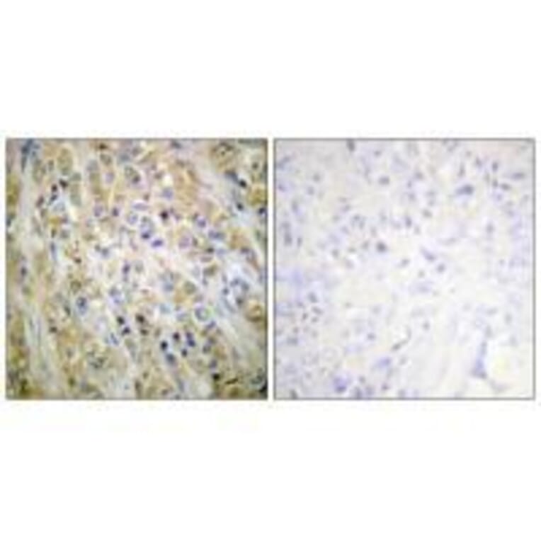 Immunohistochemistry - Prostate-specific Antigen Antibody from Signalway Antibody (33477) - Antibodies.com