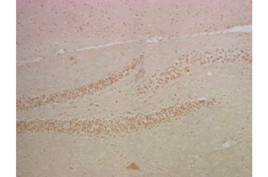 NFκB p65 Mouse Monoclonal Antibody from Signalway Antibody (38008) - Antibodies.com