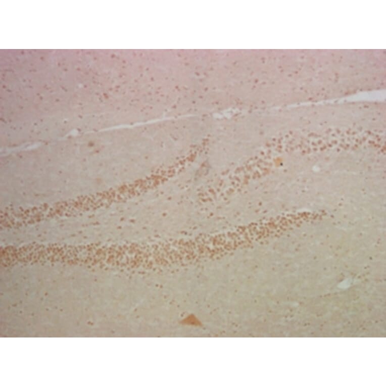 NFκB p65 Mouse Monoclonal Antibody from Signalway Antibody (38008) - Antibodies.com
