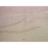 NFκB p65 Mouse Monoclonal Antibody from Signalway Antibody (38008) - Antibodies.com