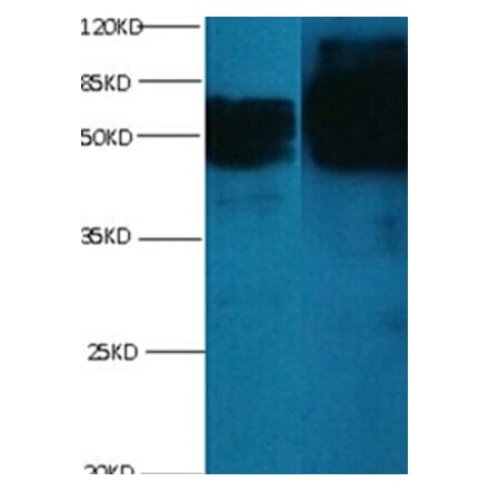 chromogranin A Monoclonal Antibody from Signalway Antibody (42019) - Antibodies.com