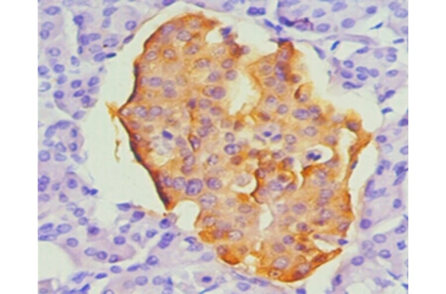 Immunohistochemistry - chromogranin A Monoclonal Antibody from Signalway Antibody (42019) - Antibodies.com