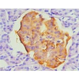 Immunohistochemistry - chromogranin A Monoclonal Antibody from Signalway Antibody (42019) - Antibodies.com