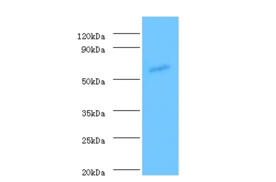 Angiopoietin-1 Polyclonal Antibody from Signalway Antibody (42439) - Antibodies.com