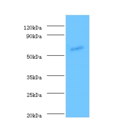 Angiopoietin-1 Polyclonal Antibody from Signalway Antibody (42439) - Antibodies.com