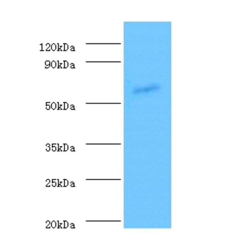 Angiopoietin-1 Polyclonal Antibody from Signalway Antibody (42439) - Antibodies.com