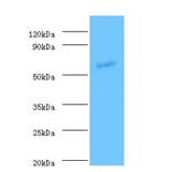 Angiopoietin-1 Polyclonal Antibody from Signalway Antibody (42439) - Antibodies.com