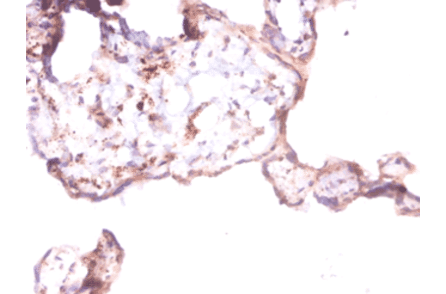 Immunohistochemistry - Angiopoietin-1 Polyclonal Antibody from Signalway Antibody (42439) - Antibodies.com