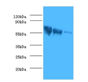Glycoprotein G Polyclonal Antibody from Signalway Antibody (42591) - Antibodies.com
