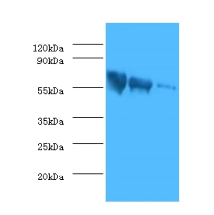 Glycoprotein G Polyclonal Antibody from Signalway Antibody (42591) - Antibodies.com