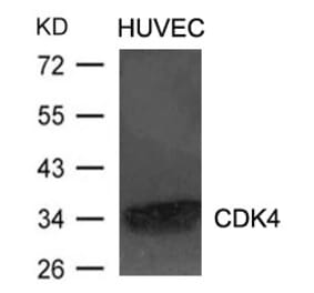 Western blot - CDK4 Antibody from Signalway Antibody (21437) - Antibodies.com