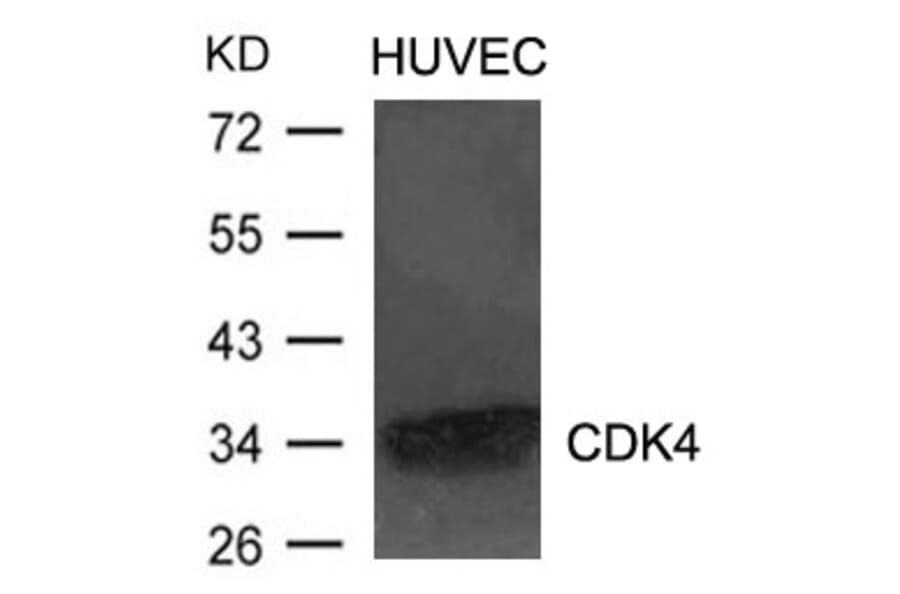 Western blot - CDK4 Antibody from Signalway Antibody (21437) - Antibodies.com