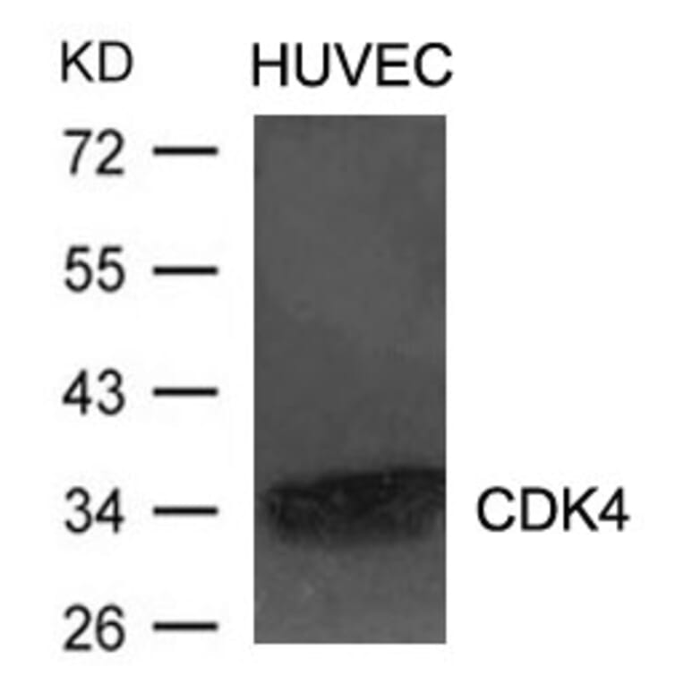 Western blot - CDK4 Antibody from Signalway Antibody (21437) - Antibodies.com