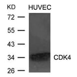Western blot - CDK4 Antibody from Signalway Antibody (21437) - Antibodies.com