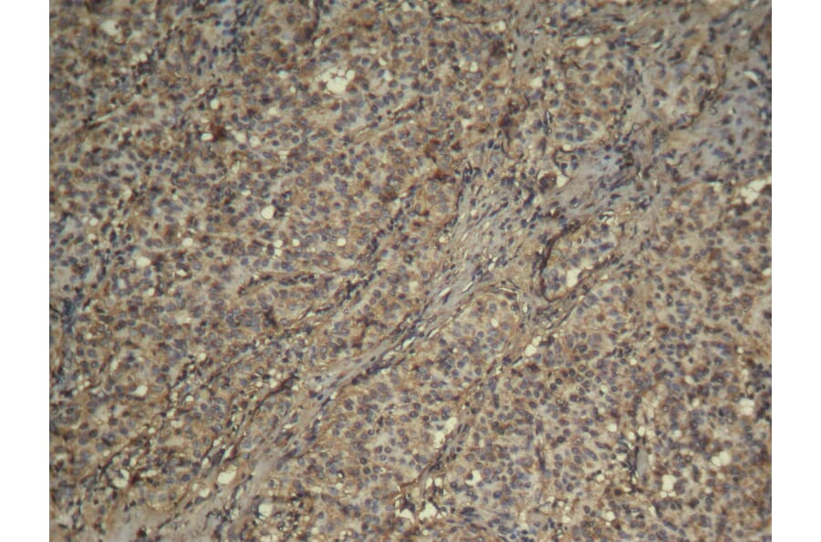 Immunohistochemistry - CDK4 Antibody from Signalway Antibody (21437) - Antibodies.com