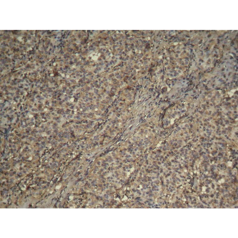 Immunohistochemistry - CDK4 Antibody from Signalway Antibody (21437) - Antibodies.com