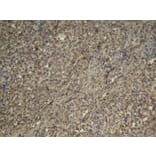 Immunohistochemistry - CDK4 Antibody from Signalway Antibody (21437) - Antibodies.com