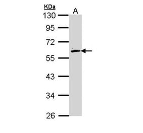 FMO2 antibody from Signalway Antibody (22009) - Antibodies.com