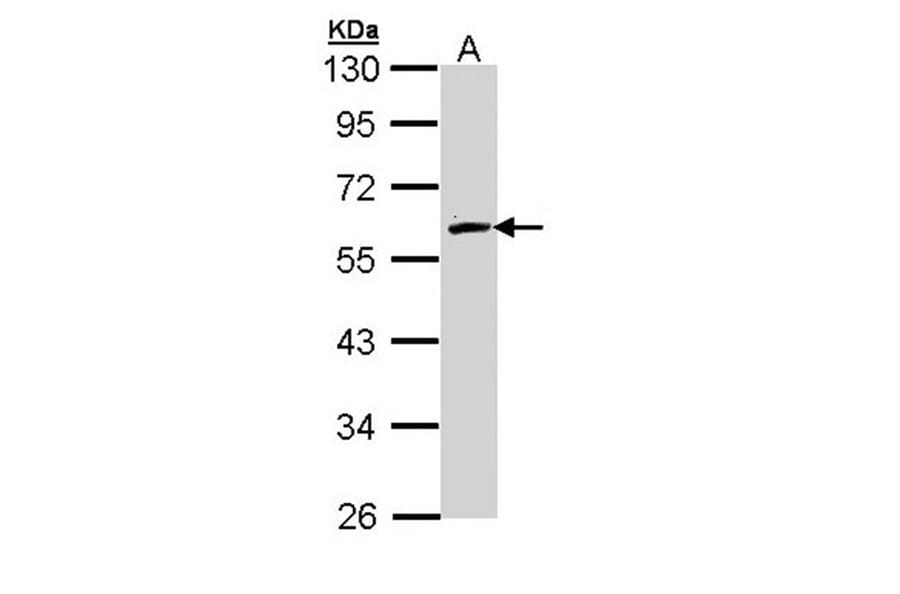 FMO2 antibody from Signalway Antibody (22009) - Antibodies.com