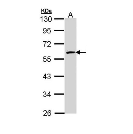 FMO2 antibody from Signalway Antibody (22009) - Antibodies.com