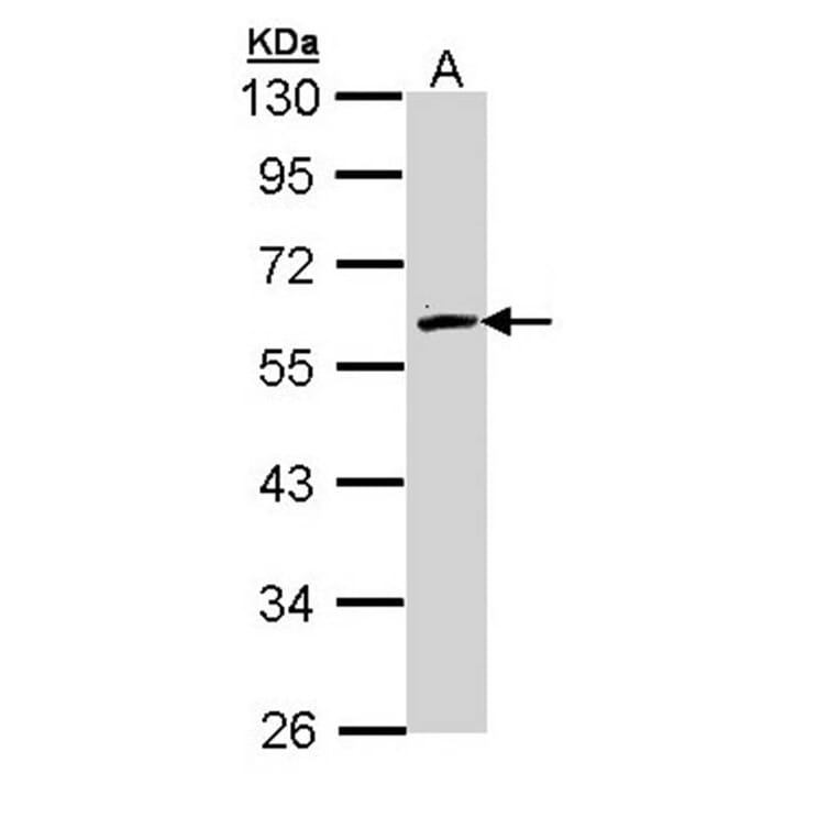 FMO2 antibody from Signalway Antibody (22009) - Antibodies.com