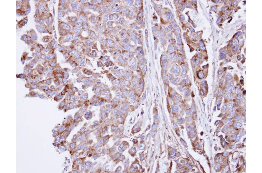 Immunohistochemistry - SGSH antibody from Signalway Antibody (22030) - Antibodies.com