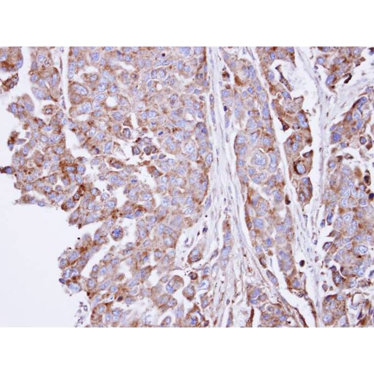 Immunohistochemistry - SGSH antibody from Signalway Antibody (22030) - Antibodies.com