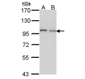 EPS8 antibody from Signalway Antibody (22105) - Antibodies.com