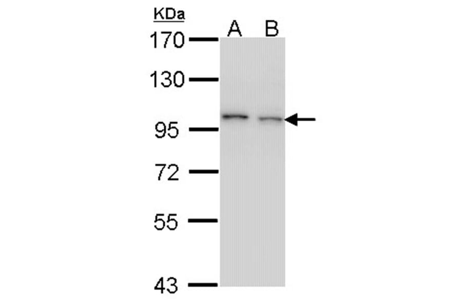 EPS8 antibody from Signalway Antibody (22105) - Antibodies.com