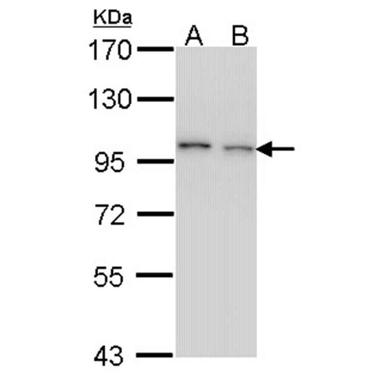 EPS8 antibody from Signalway Antibody (22105) - Antibodies.com